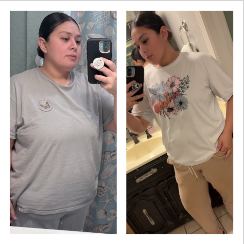 Claudia M. Gastric Bypass Revision Update After 9 Months *